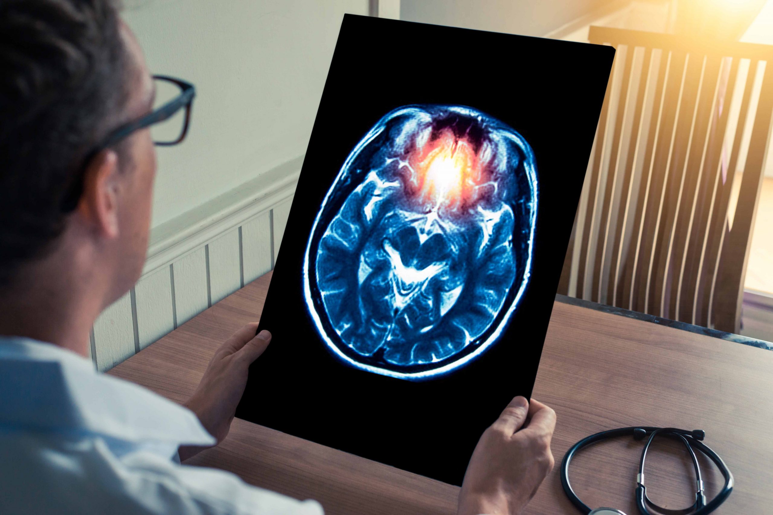 Migraine-Surgery-1