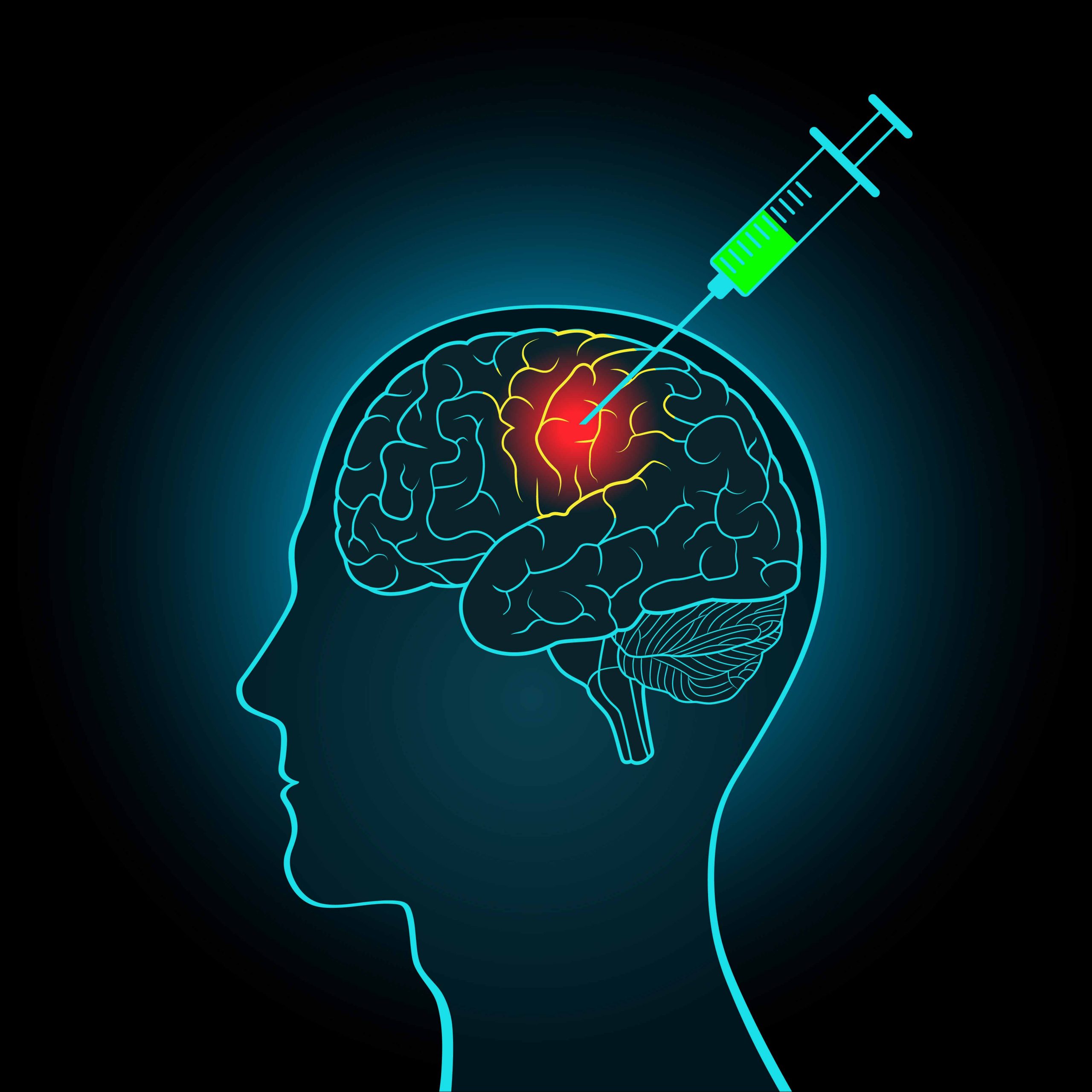 Migraine-Surgery-2