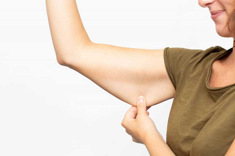 Arm Lift Surgery