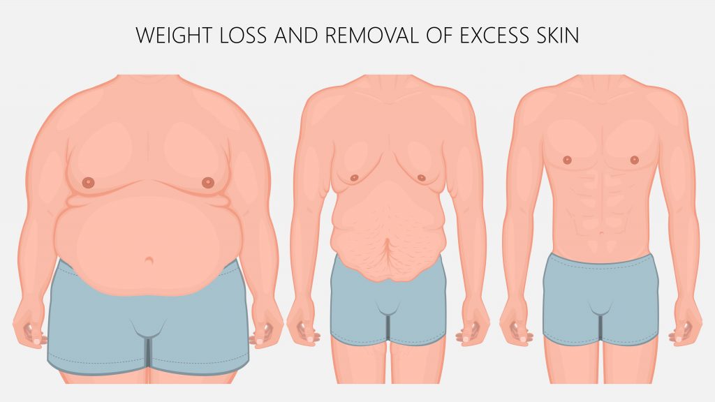 Plastic Surgery
