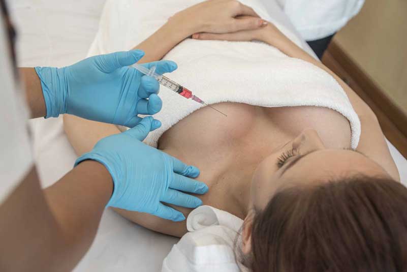 Breast-Implant-Removal-1