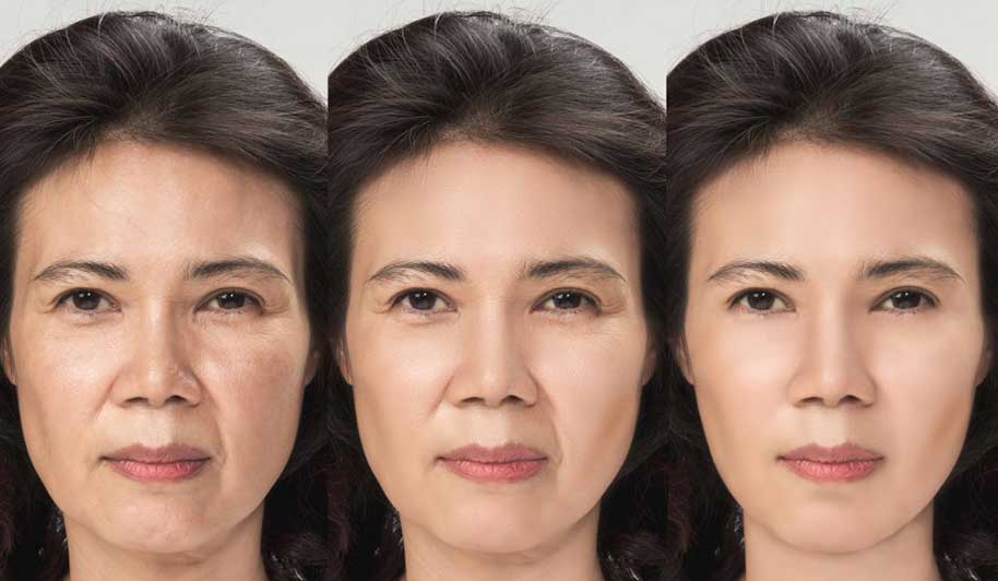 Plastic Surgery