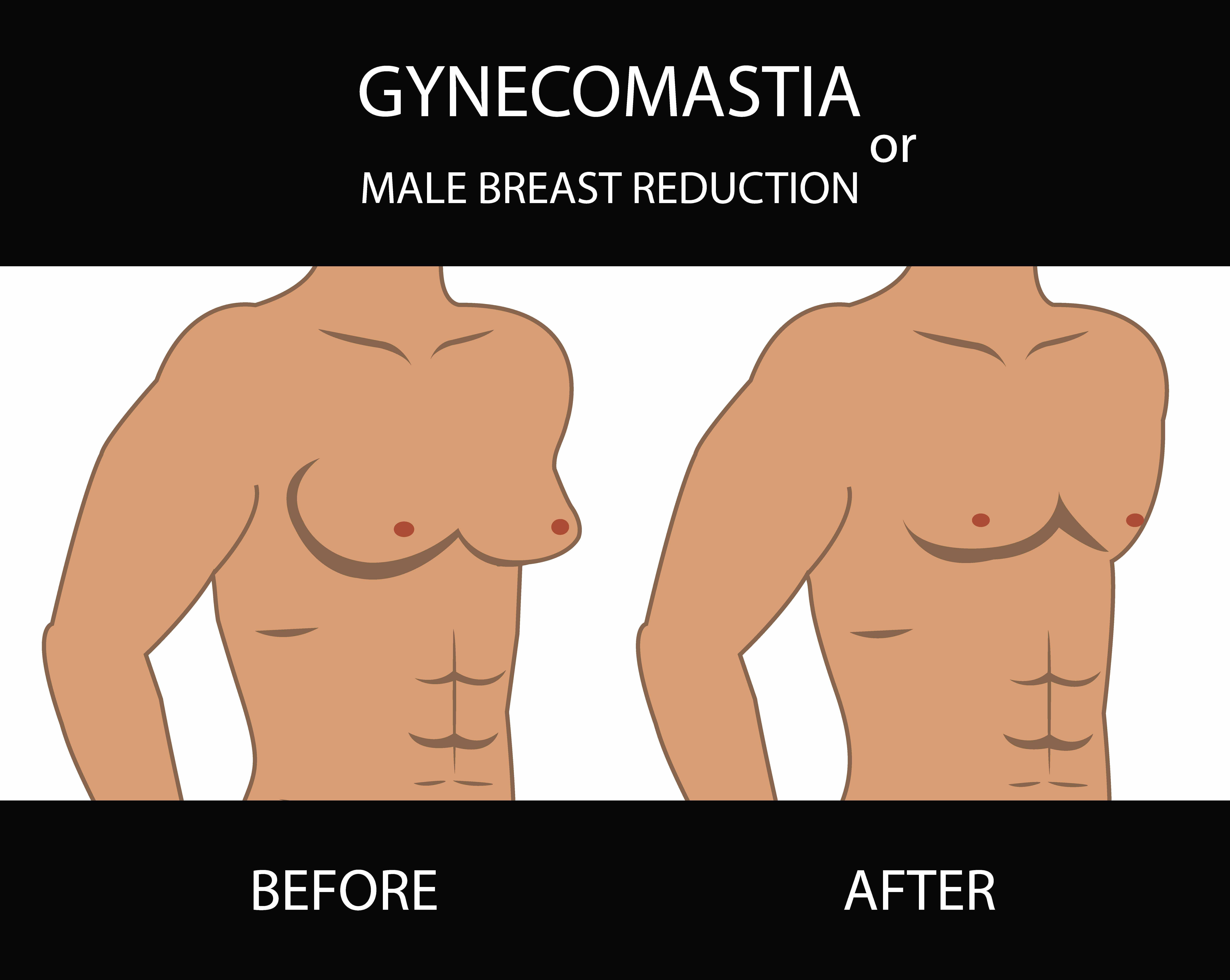 Plastic Surgery