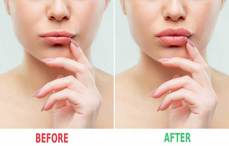 Plastic Surgery