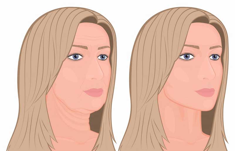 Plastic Surgery